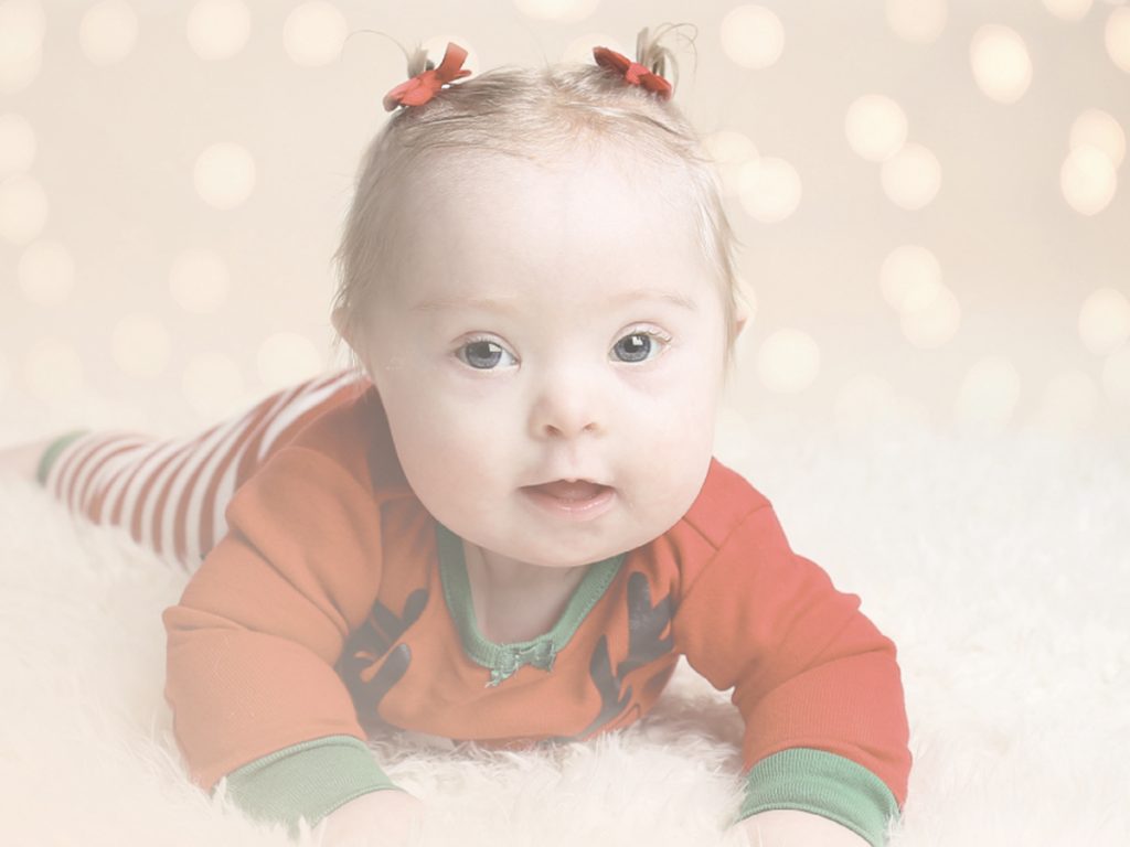 Baby with Downs Syndrome.